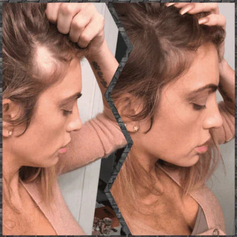 Hair Max - Sombreador de Fibras Capilares